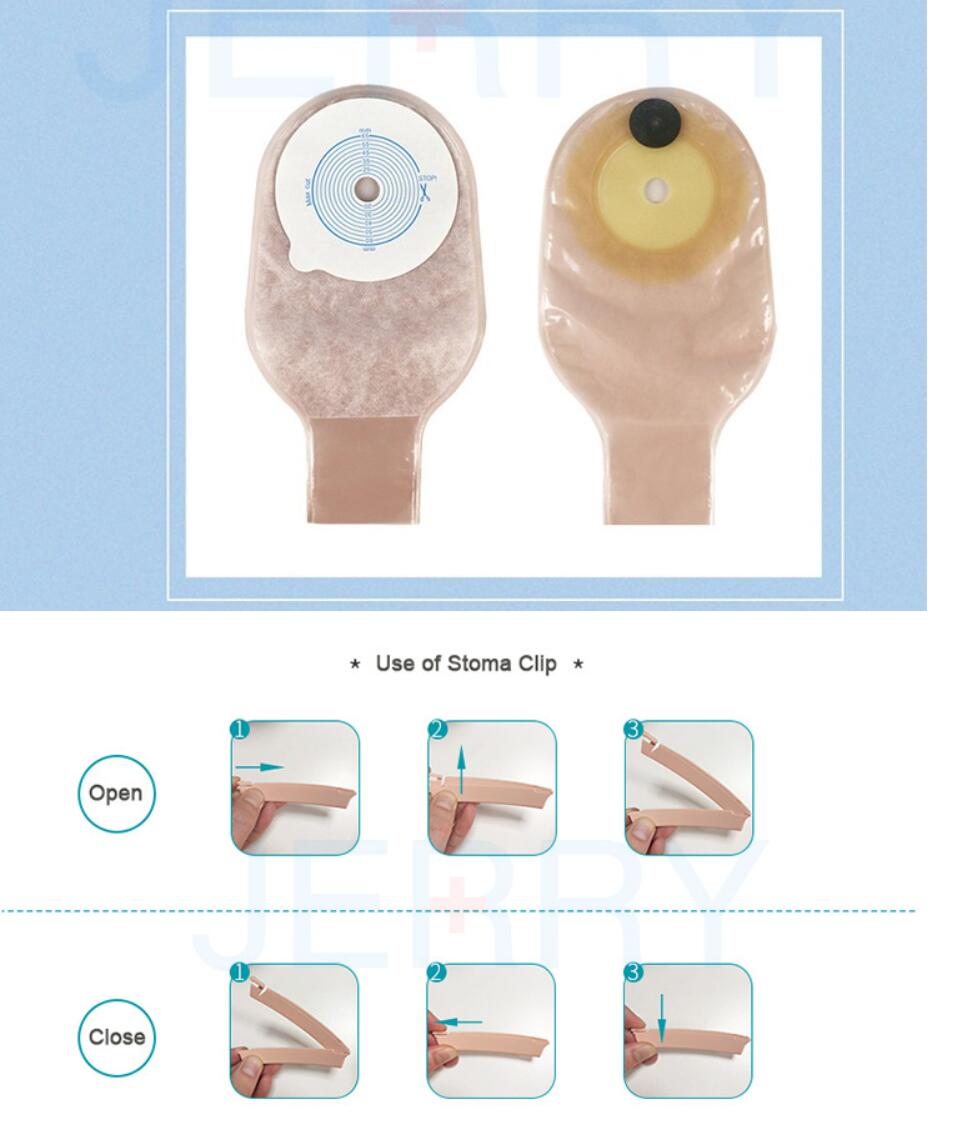 Different Types Stoma Bag Drainable Colostomy Bags Buy Product on
