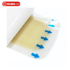 Hydrocolloid Adhesive Wound Dressing